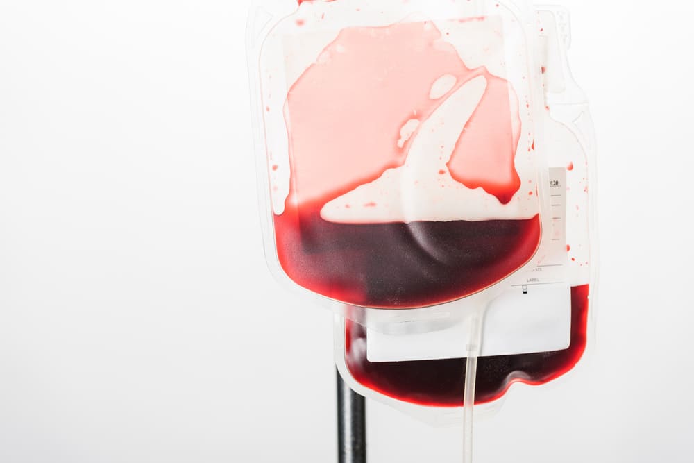 krew-pacjent w czasie oddawania krwi