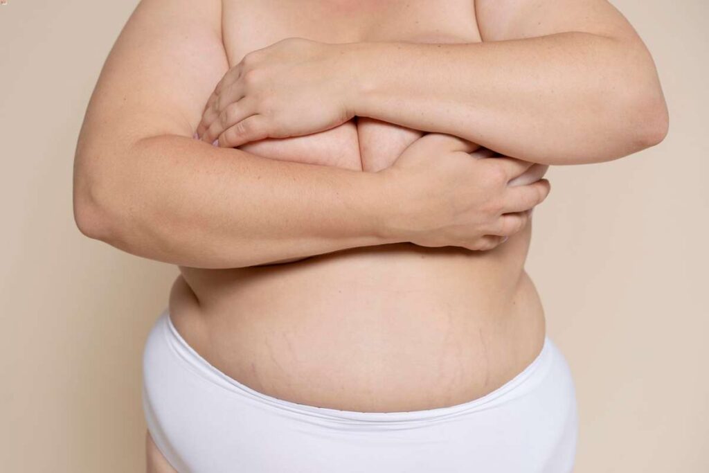 Powikłania otyłości – z czym mierzą się pacjenci?